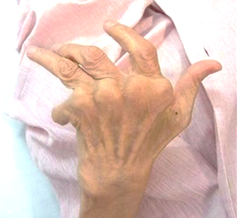 大村恵昭博士とoリングテストの歴史 Oリングテスト Oリングテストの歴史 Oリングテストとakの違い